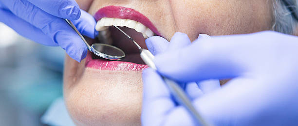 Best Chipped Tooth Repair Near Me  in Wallis, TX
